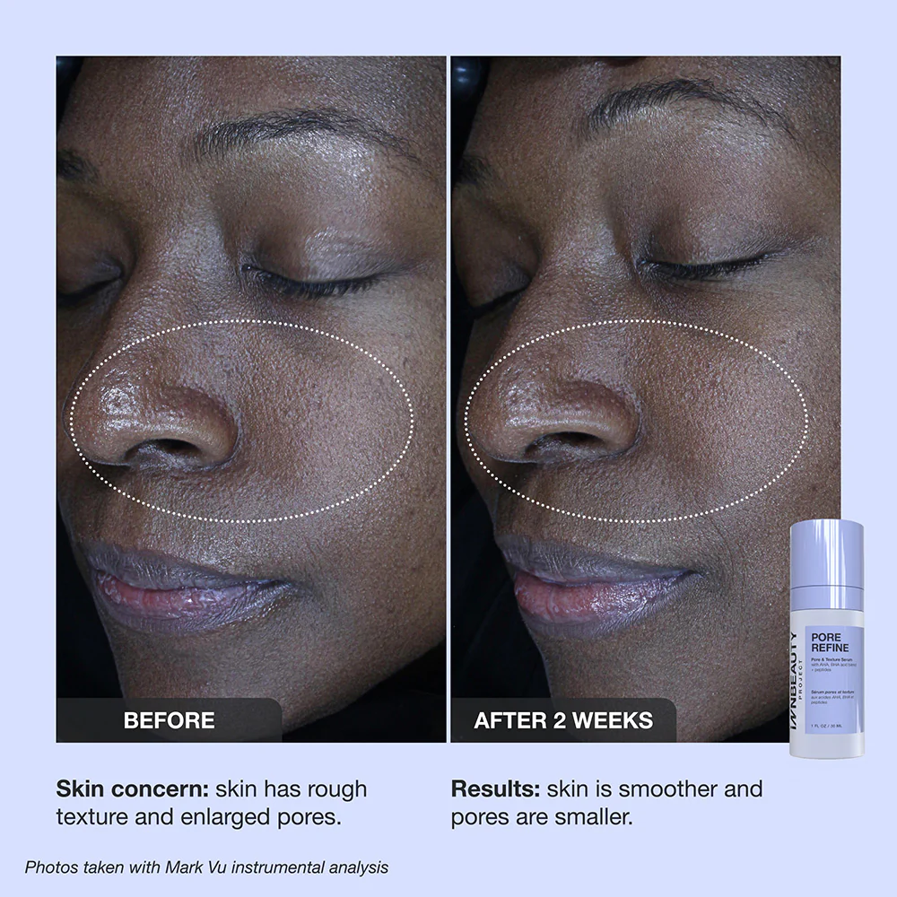 Pore Refine - Image 9